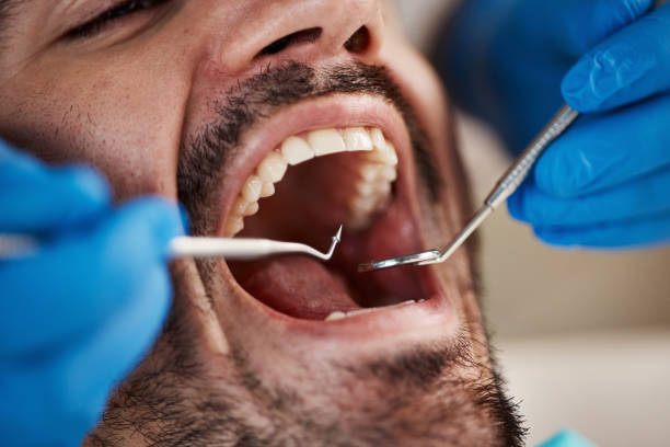 Best Emergency Dental Services for Seniors in Davisboro, GA