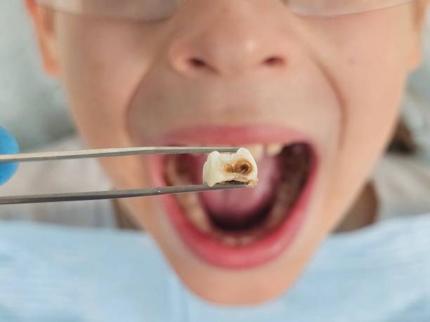 Best Urgent Dental Care for Toothache in Davisboro, GA